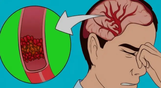 هفت نشانه که به اندازه کافی آب نمی نوشید