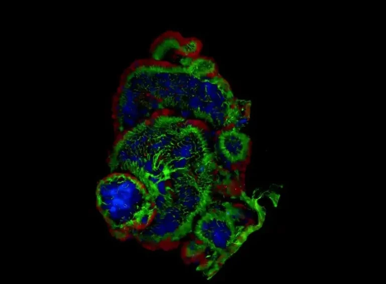 توده شگفت انگیز، شبیه مغز انسان