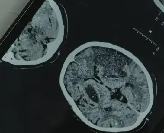 تاثیر منفی گرایی بر مغز