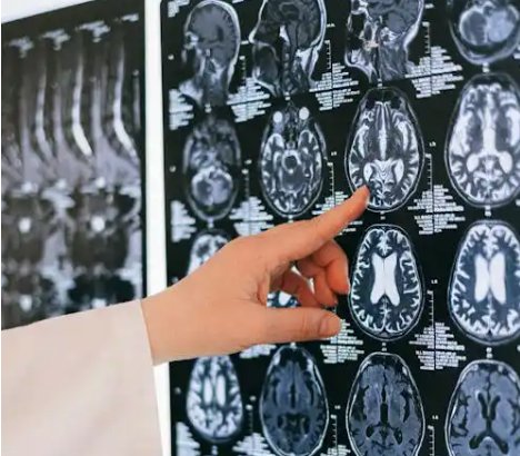 تأثیر روزه بر عملکرد مغز