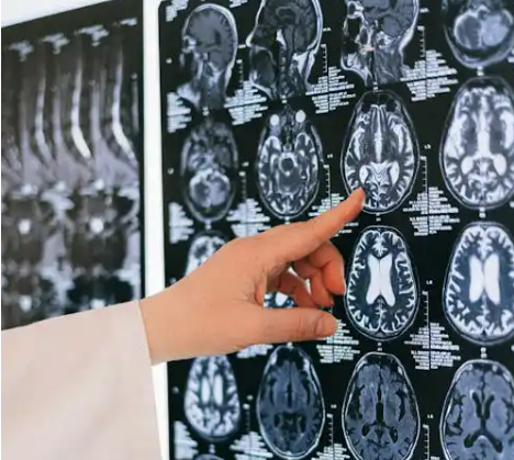 تأثیر روزه بر عملکرد مغز